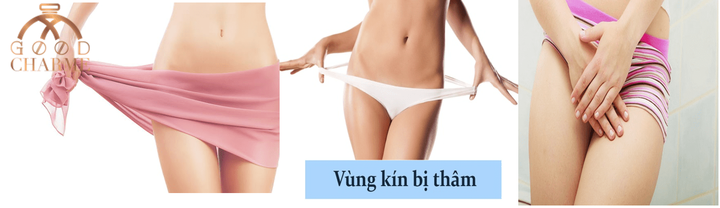 Gel Trị Thâm Vùng Kín Inner Perfume