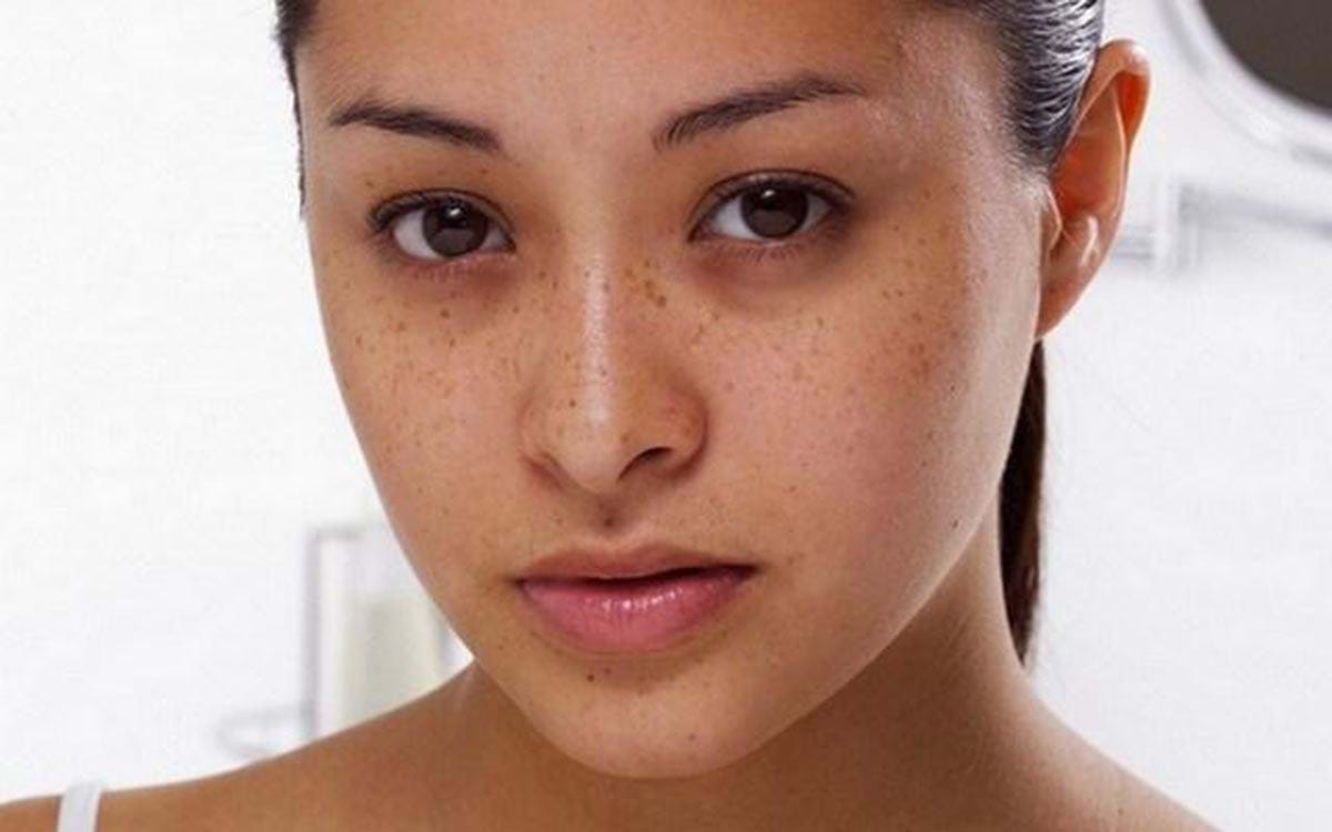 Chăm chăm đắp mặt nạ, chị em có biết da mụn hay da nám đều cần công thức khác nhau?